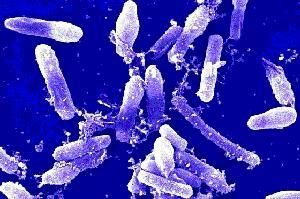 Types (Infections and intoxications): Food Borne Disease 1 Types (Infections and intoxications): Food Borne Disease 1