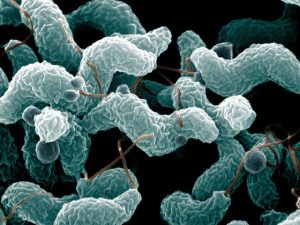 Types (Infections and intoxications): Food Borne Disease 5 Types (Infections and intoxications): Food Borne Disease 5