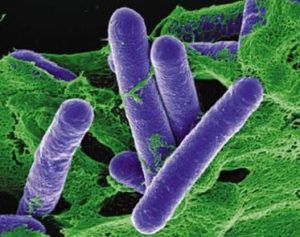 Types (Infections and intoxications): Food Borne Disease 2 Types (Infections and intoxications): Food Borne Disease 2
