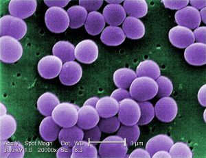 Types (Infections and intoxications): Food Borne Disease 4 Types (Infections and intoxications): Food Borne Disease 4