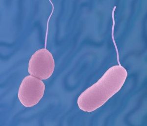 Types (Infections and intoxications): Food Borne Disease 13 Types (Infections and intoxications): Food Borne Disease 13
